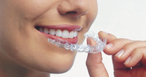 Woman smiles while removing Invisalign aligners from her mouth