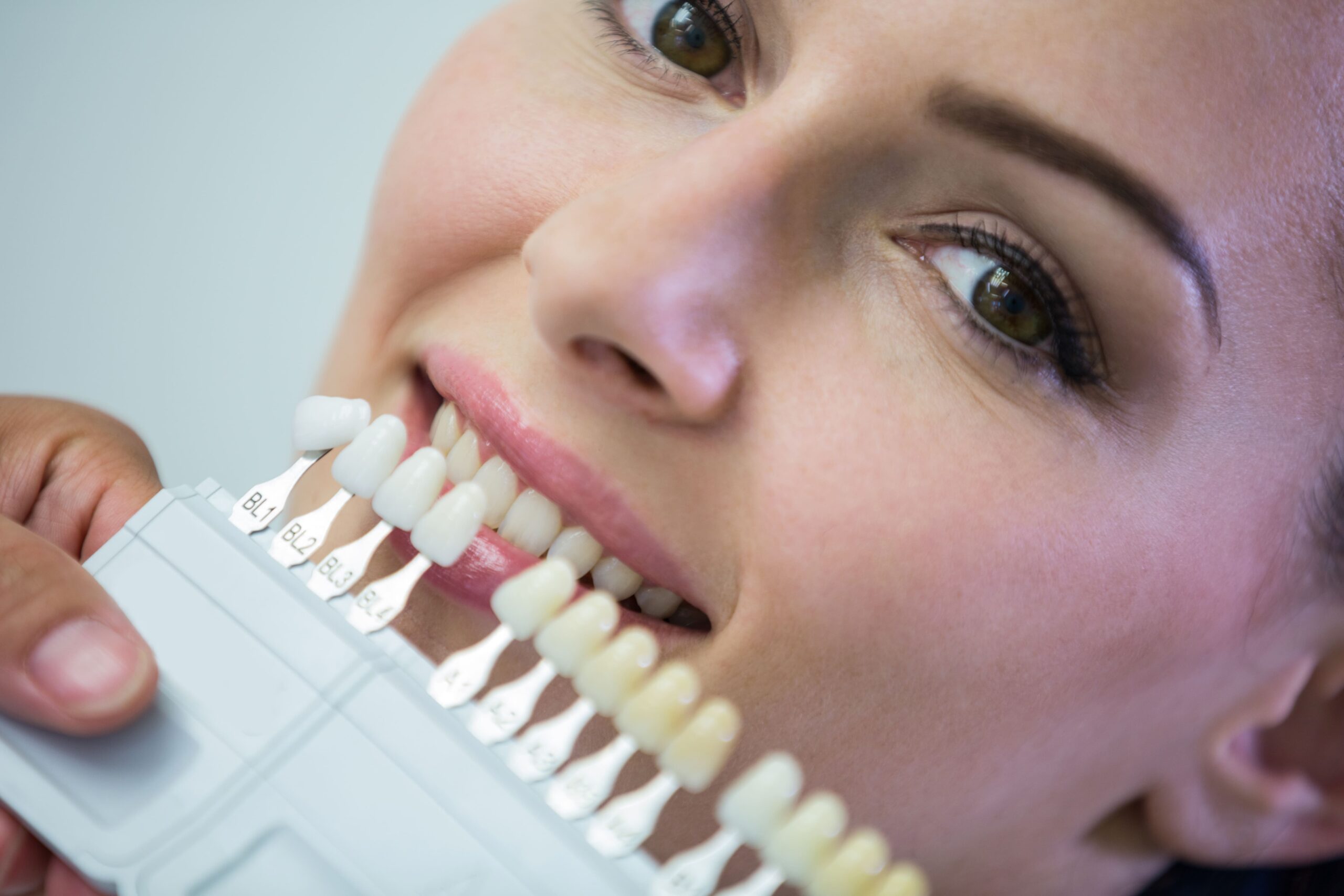 Featured image for “Are Dental Veneers Durable? ”