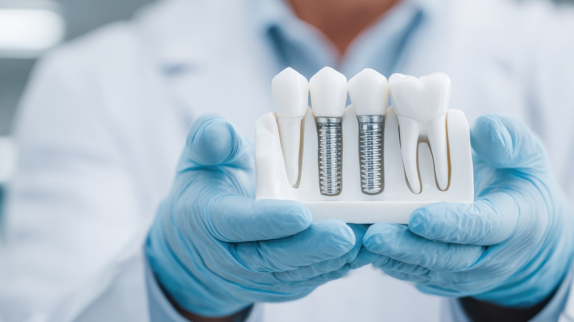Dental implant consultation at Roseborough Dental, Eglinton and Creditview, Mississauga